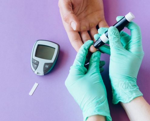 Diabetes und dauerhafte Haarentfernung 2